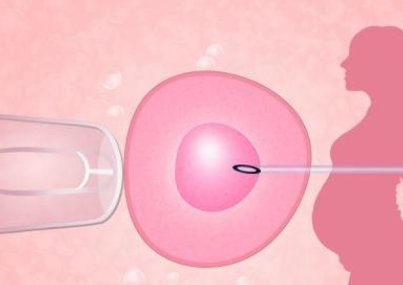 2026年马来西亚二代试管报价，附花费明细情况